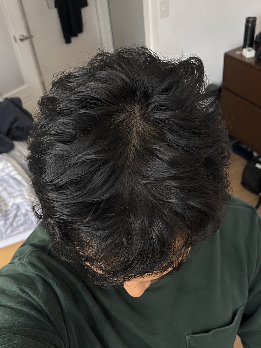 After